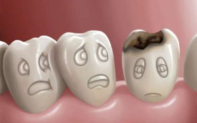 Como evitar a cárie dentária?
